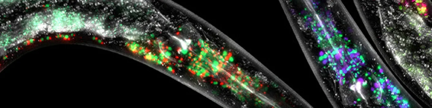 Therapy-induced DNA methylation inactivates MCT1 and renders tumor cells vulnerable to MCT4 inhibition
