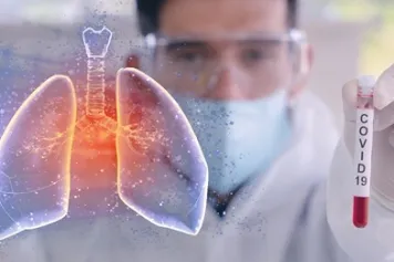 La libération excessive de filets d’ADN de neutrophiles dans les poumons pourrait expliquer les complications sévères chez les patients atteints de la Covid-19