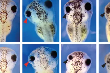 Comment la formation des ribosomes peut-elle affecter les maladies spécifiques aux tissus ?