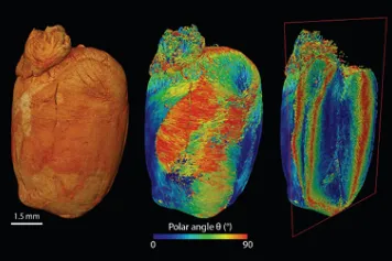 Les tissus et organes en 3D pour comprendre les maladies