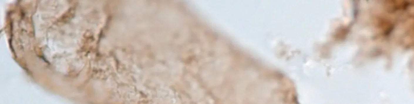 Aux origines de la photosynthèse