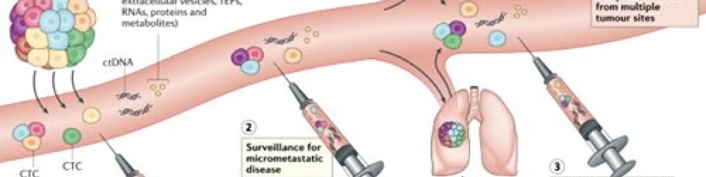 PUBLICATION SCIENTIFIQUE | ? Les biopsies liquides entrent dans la routine clinique 
