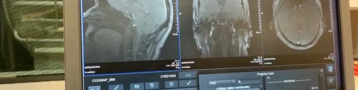 Le cerveau humain dans l'espace