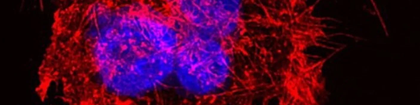 PUBLICATION SCIENTIFIQUE | FAT1 : découverte d'un gène dont la mutation favorise les métastases de certains cancers