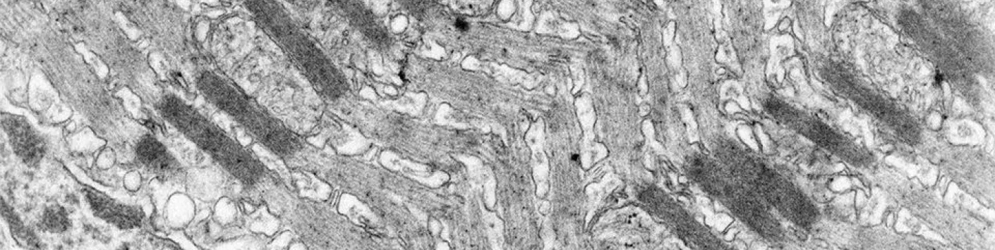 Fibres musculaires : une organisation inattendue