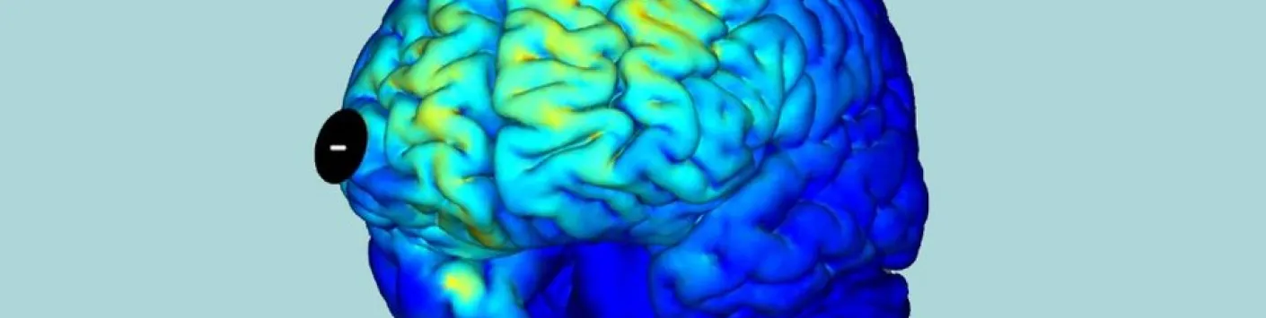 De nouvelles perspectives encourageantes pour le traitement des troubles de la conscience