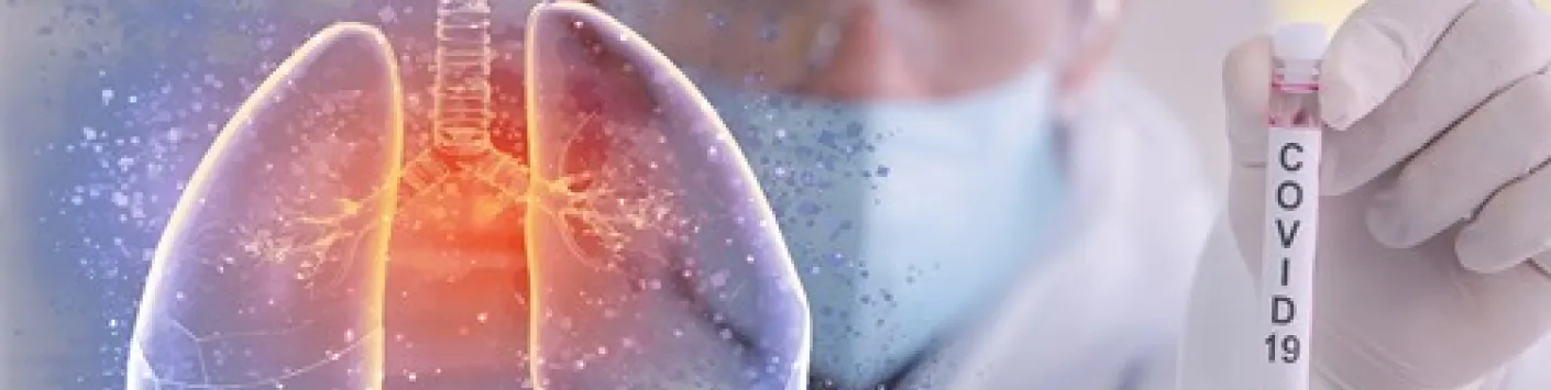 La libération excessive de filets d’ADN de neutrophiles dans les poumons pourrait expliquer les complications sévères chez les patients atteints de la Covid-19