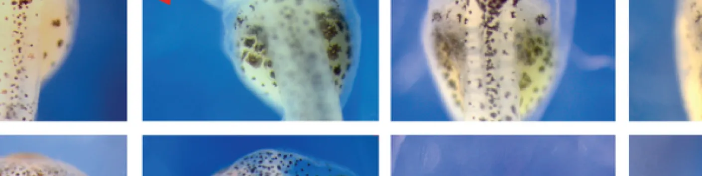 Comment la formation des ribosomes peut-elle affecter les maladies spécifiques aux tissus ?