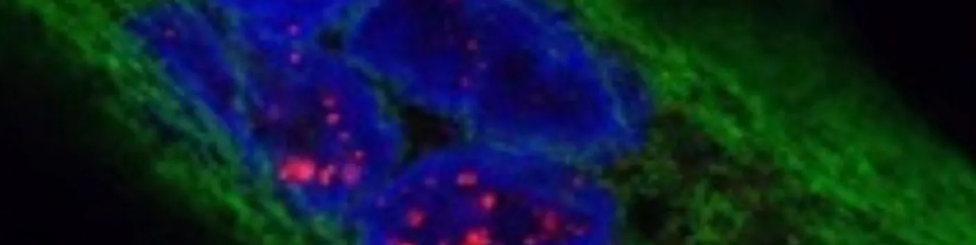 Une nouvelle stratégie thérapeutique potentielle pour la maladie de Steinert